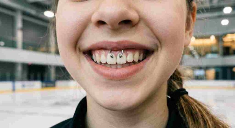 Alysa Liu Teeth