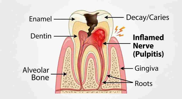 back teeth pain